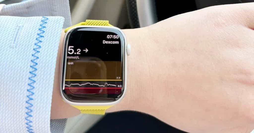 Nuove possibilità nella gestione del diabete